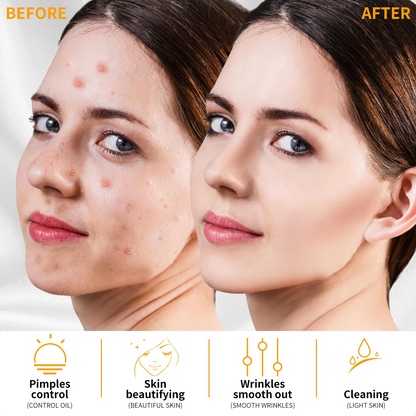 High F Rrequncy Portable Handheld Facial Skin Care Wand Machine