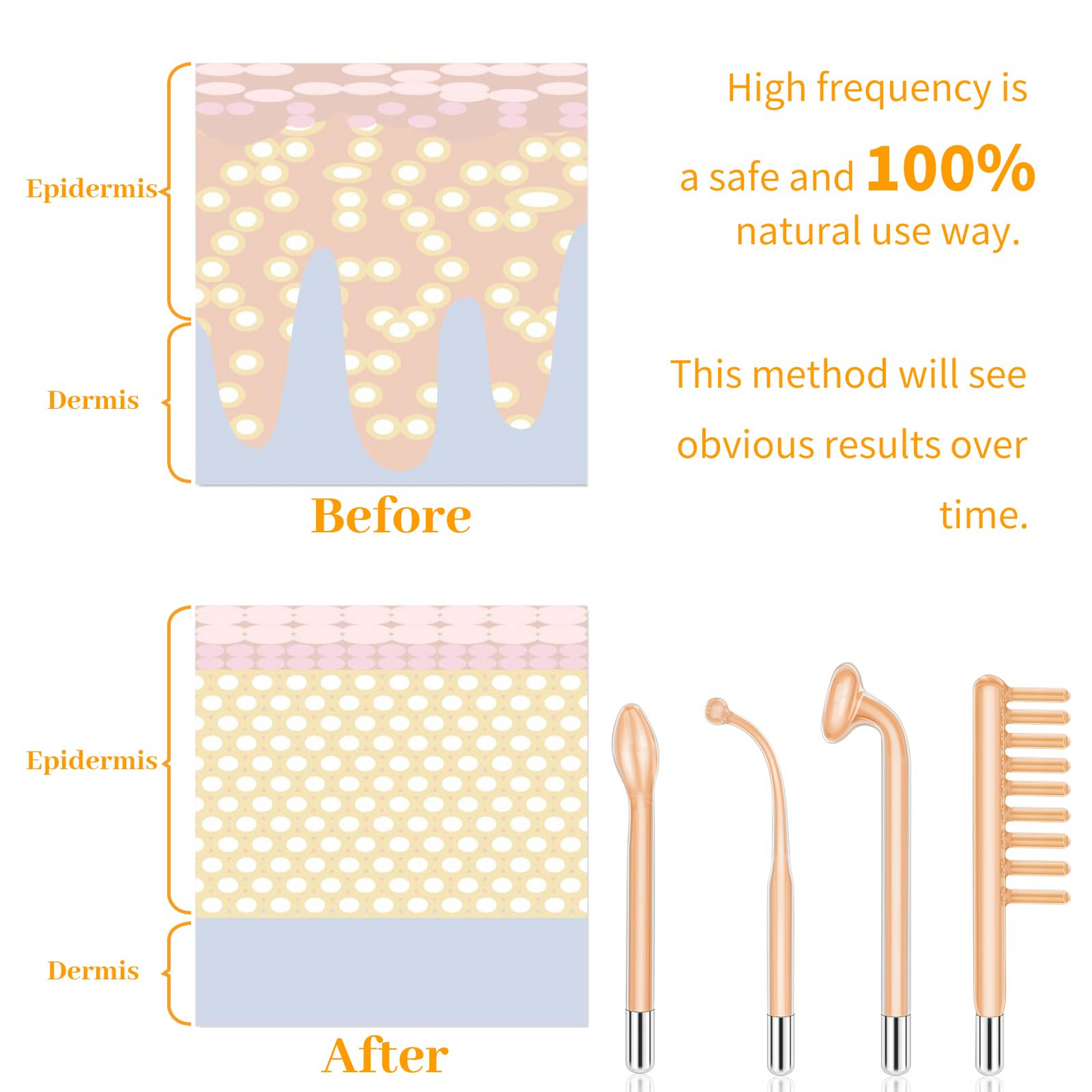 High F Rrequncy Portable Handheld Facial Skin Care Wand Machine