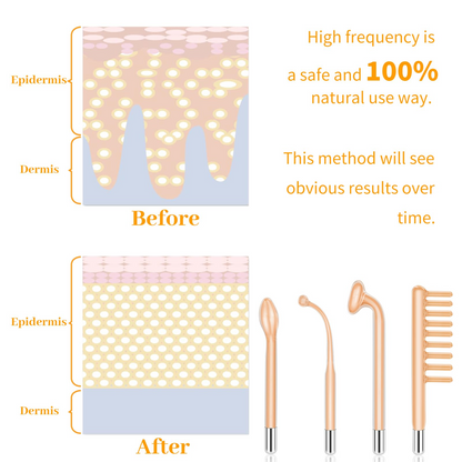 High F Rrequncy Portable Handheld Facial Skin Care Wand Machine