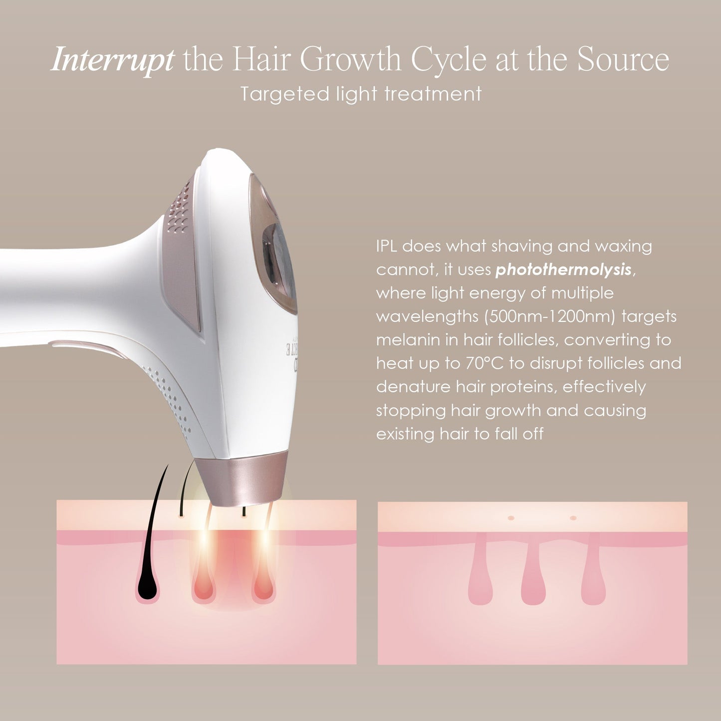 SmoothPro+ | IPL Hair Removal Device
