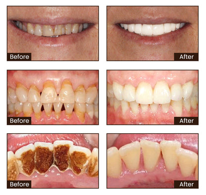 BodyAccel Whitening Toothpaste