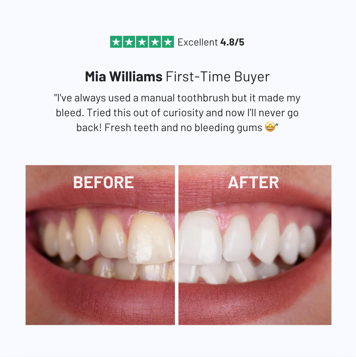 LumoBrush 360° Toothbrush & Whitener