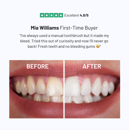 LumoBrush 360° Toothbrush & Whitener